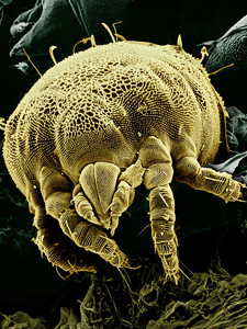 Un Ácaro Microscópico © Erbe, Pooley: USDA, ARS, EMU